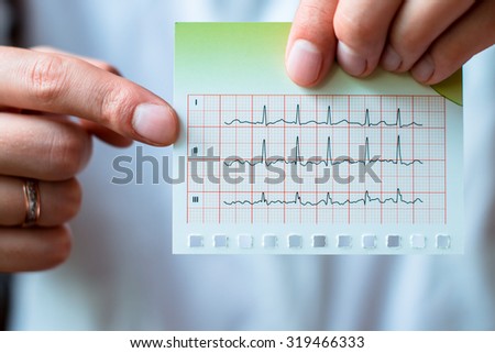 Electrocardiogram, ecg in hand, palm of a doctor. Medical health care. Clinic cardiology heart rhythm and pulse test closeup. Cardiogram printout.