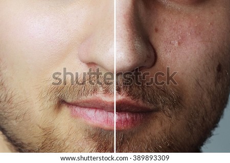 Before and after cosmetic operation. Young man portrait, isolated on a white background. Before and after cosmetic or plastic procedure, anti-age therapy, removal of acne, retouching. studio shot