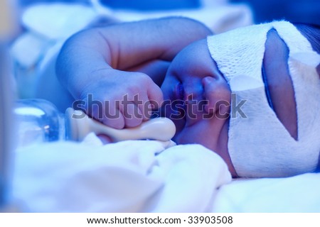 newborn baby under ultraviolet lamp in the incubator