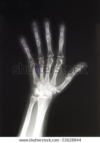 X-ray of human hand with space for copy