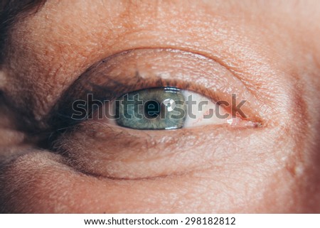 Eye wrinkles close up