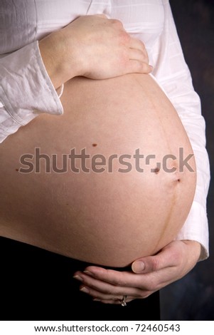 Pregnant woman\'s abdomen with linea nigra caused by increases in estrogen and progesterone. It illustrates increased production of pigment melanin called hyperpigmentation.