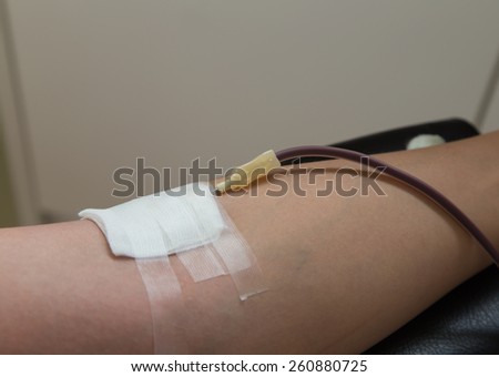 Closeup of blood donor at donation.