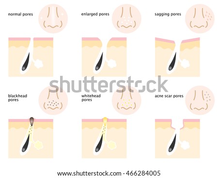 image vector there kinds skin pores normal sagging image vector there kinds skin pores normal sagging