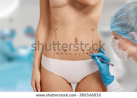 Plastic surgery doctor draw line on patient breast augmentation implant. Woman belly marked out for cosmetic surgery in surgery room interior