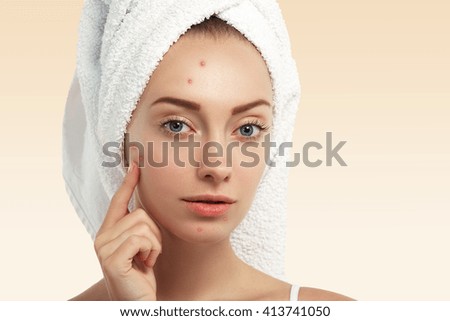 Close up shot of young Caucasian female with blue eyes and acne skin, pointing at pimple, looking at the camera while getting facial treatment in spa salon. Dermatology and problem skin concept