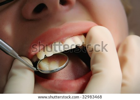 white teeth mouth with dental mirror