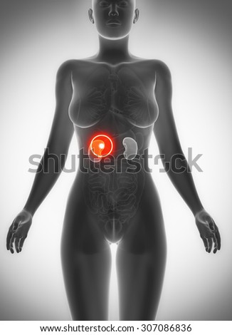 Female kidney anatomy x-ray  pain concept