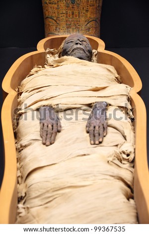 Open Casket