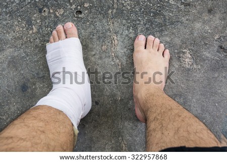 Foot and Ankle injury with bandage