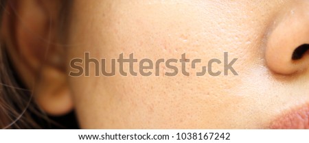 close up wide pores skin on oily face of asia woman