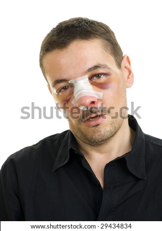 Badly Broken Nose