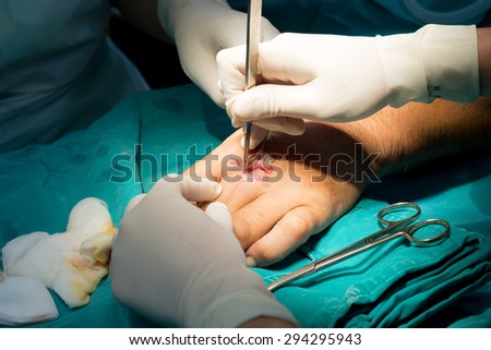 Hand surgery in operation room