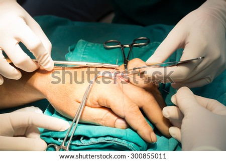 hand surgery  repair tendon
