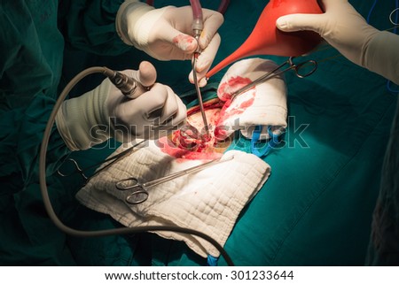 neurology  surgery