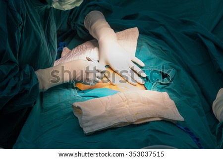 cesarean in operation room