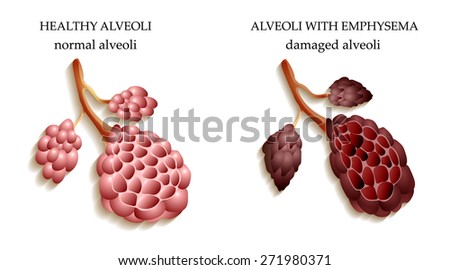 pneumonia nicotine and respiratory health pneumonia nicotine and respiratory health