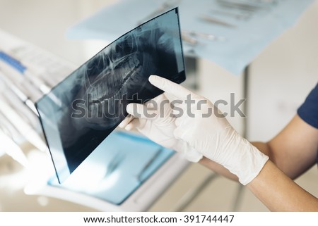 Doctor talking with her patient and teaching a radiograph. Medical Concept.