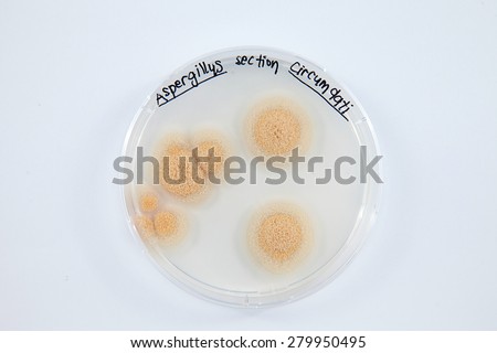 colony on agar plate isolated