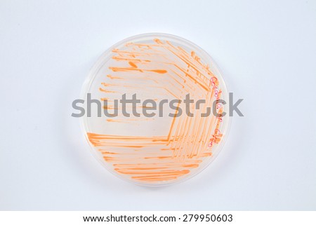 colony on agar plate isolated