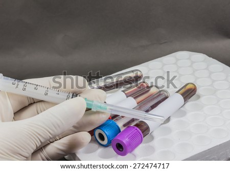 Syringe, needle and specimen on tube blood collection for test in laboratory.