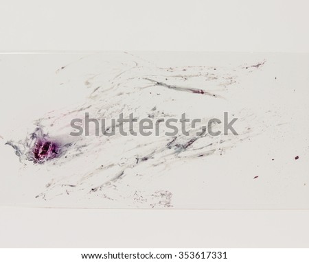 Slide Pap smear for diagnosis in pathology laboratory.