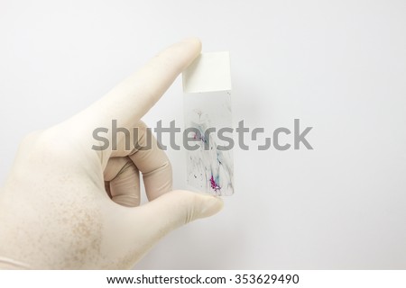 Slide Pap smear in the hand for diagnosis in pathology laboratory.