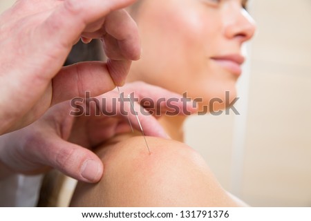 Doctor hands acupuncture needle pricking on woman patient closeup