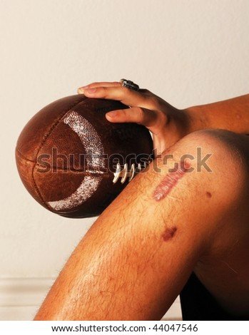 injury in football. ACL knee football injury