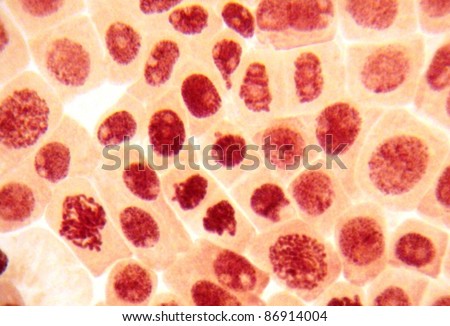 Real photo of many damaged cells (destruction of interphase chromatin and pathology of nucleoli)