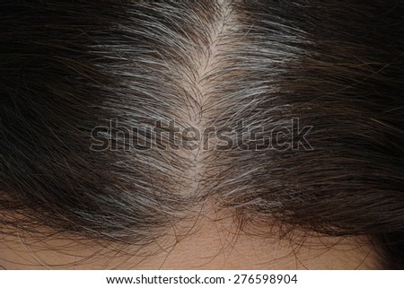 Going gray. Young woman shows her gray hair roots.