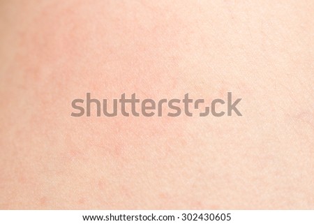 Soft focus human skin texture with allergy and black hairs on the skin for healthy background concept