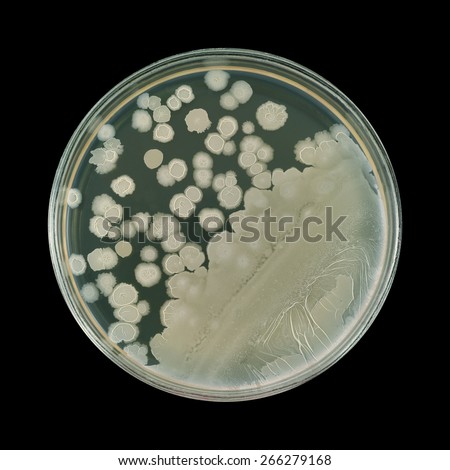 Similar light bacterial colonies on a petri plate isolated on a black background