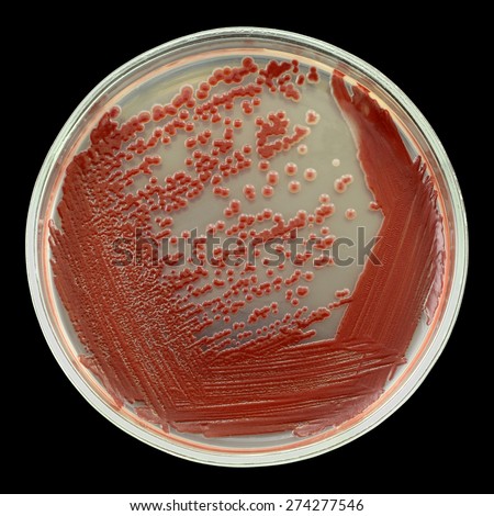 Red Bacterial Colonies On A Petri Dish (plate) Isolated On A Black 