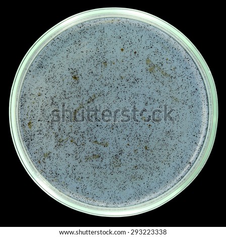 Sterile agar petri plate with small drops of crude oil. All spots and dots are petroleum drops. This media will be used for oil-degrading microorganisms cultivation. Isolation on the black background.