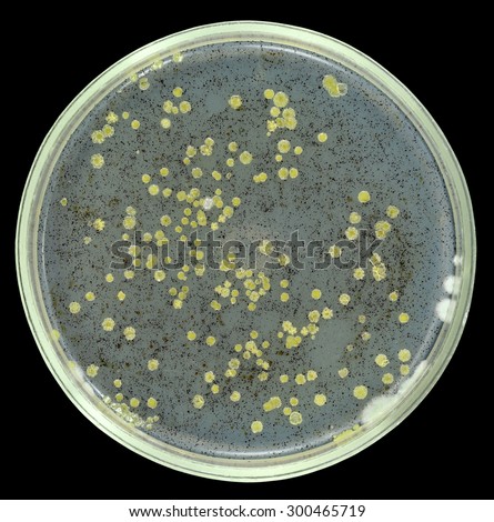 Oil oxidizing (degrading) bacteria from sea water grows on agar petri plate with small drops of crude oil as nutrient source. Isolation on a  black background.