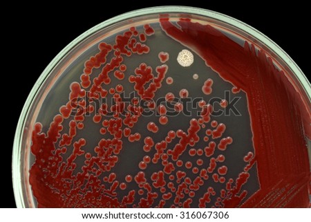 Bacterial colonies on an agar surface macro photo. Nutrient agar media contains small light grains. Focus on all agar surface. Isolated on a black background.