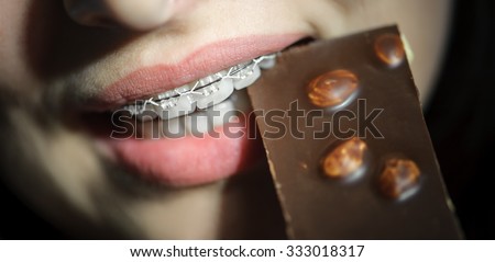 young girl eating chocolate, with ceramic teeth braces