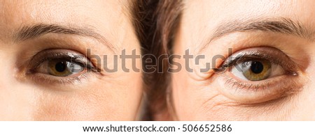 Female eyes with and without wrinkles