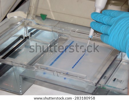 DNA test father paternity in agarose gel.