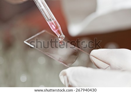 Hands with laboratory equipment - medical and chemical instruments