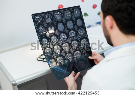 Young male physician reading and reviewing a MRI brain scan
