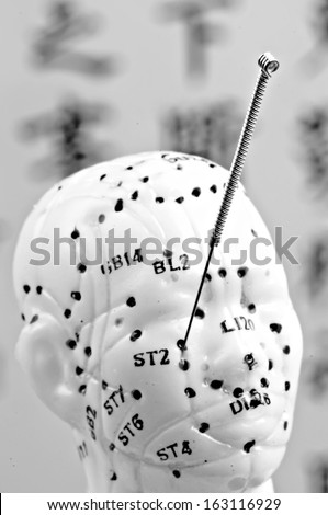 acupuncture needle on head model