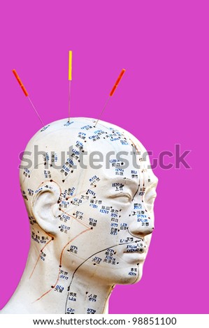 Acupuncture needles on head model