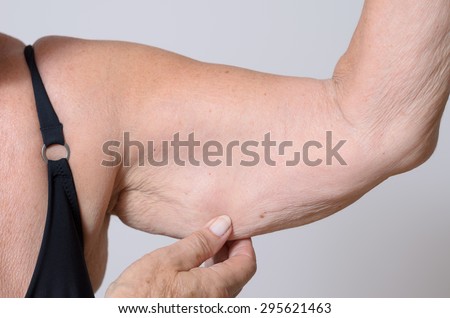 Elderly lady displaying the loose skin or flab due to ageing on her upper arm pinching it between her fingers, close up view