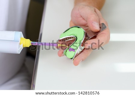 close-up of dentist\'s hands holding teeth impression instruments
