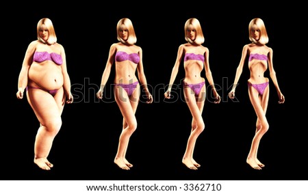 An image of a women who has gone from being fat to very very thin, a useful image about weight loss.