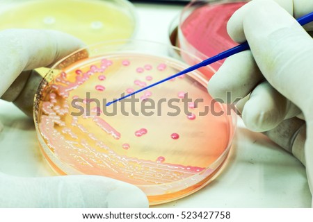 Pink Bacteria lactose ferment colonies culture growth on MacConkey agar media in experimental laboratory Hospital white background