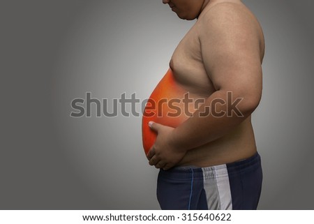 Male obesity has severe abdominal pain.