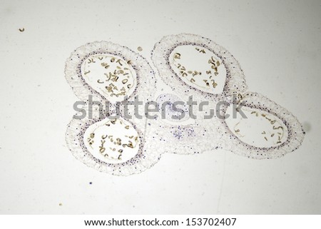 Microscopic section of lily anther